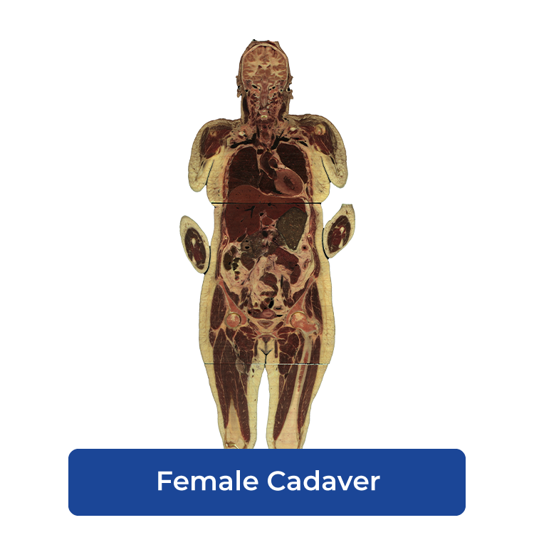 Cadaviz female cadaver