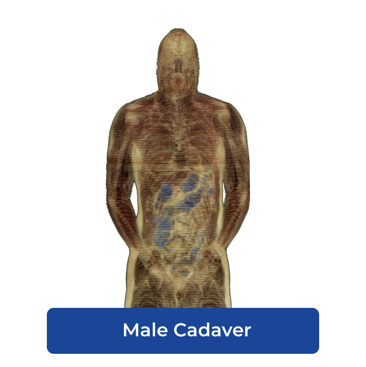 Cadaviz male cadaver