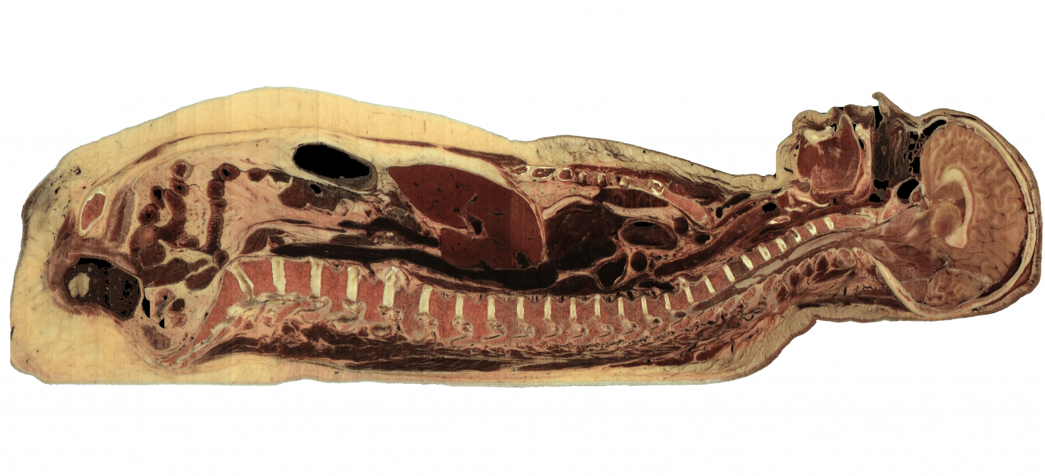 Female cadaver saggital anatomical view